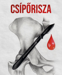 Csípőrisza