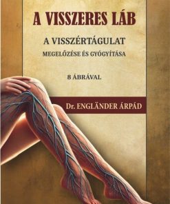 A visszeres láb a visszértágulat megelőzése és gyógyítása